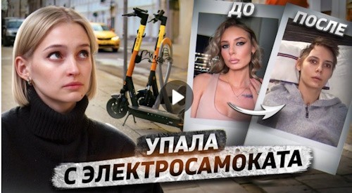 Жительница Новосибирска упала с электросамоката и стала инвалидом